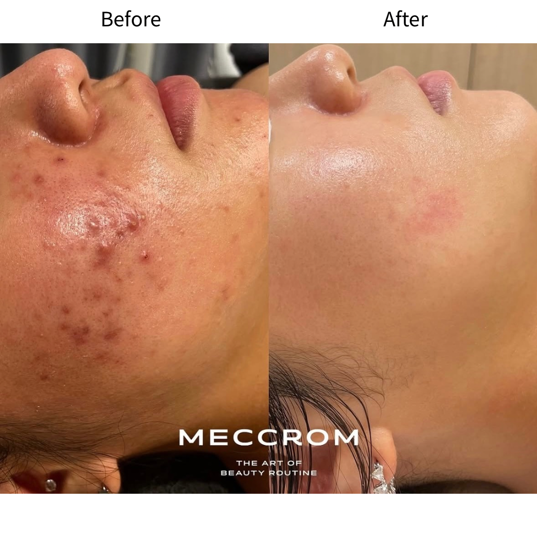 아픈 피부 케어 확장