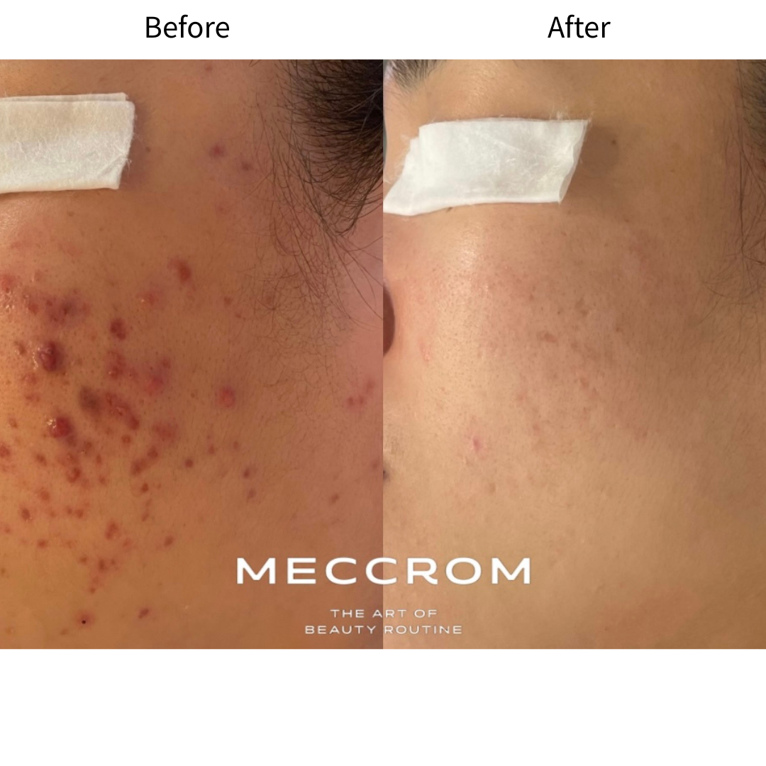 피부 안정 · 결 개선